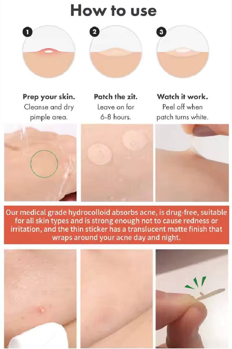 Original Hydrocolloid Acne Pimple Patch